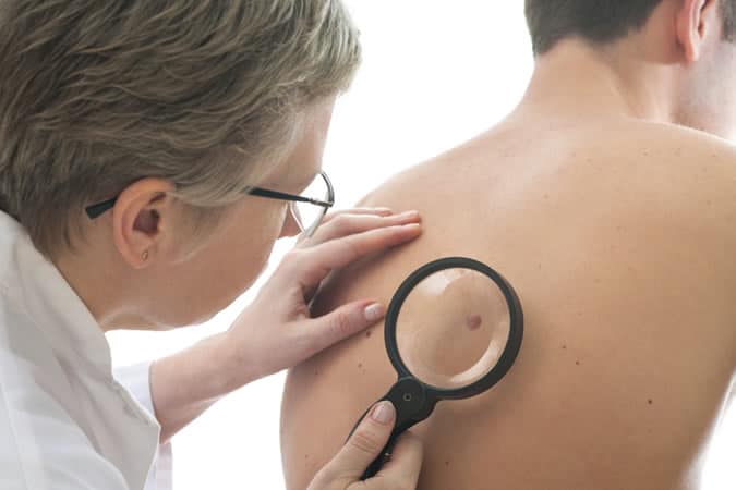 Skin Cancer Screening