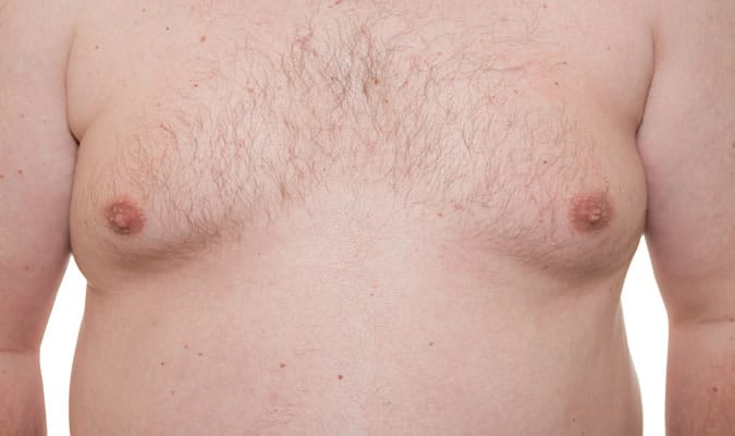 man boobs