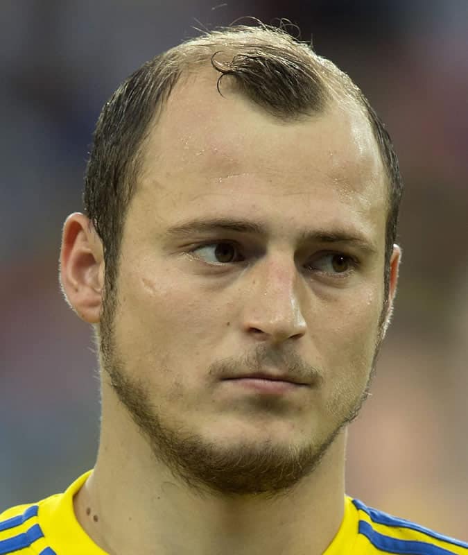 Roman Zozulya (Ukraine) Euro 2016 Haircut