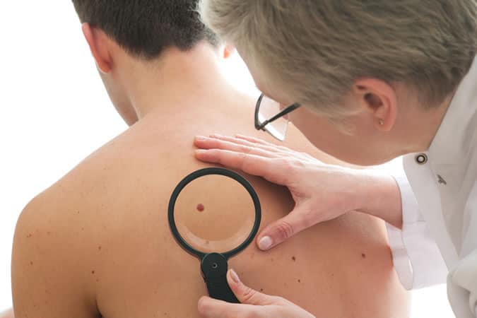 Check your moles