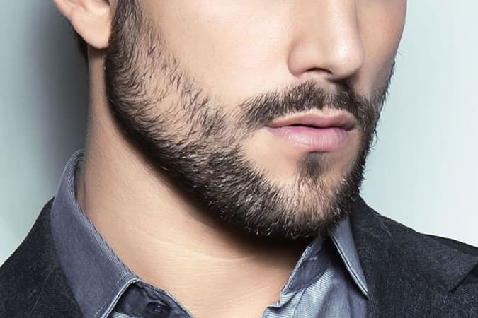 Beard Transplant
