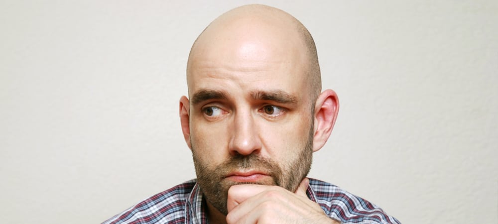What to do when balding young