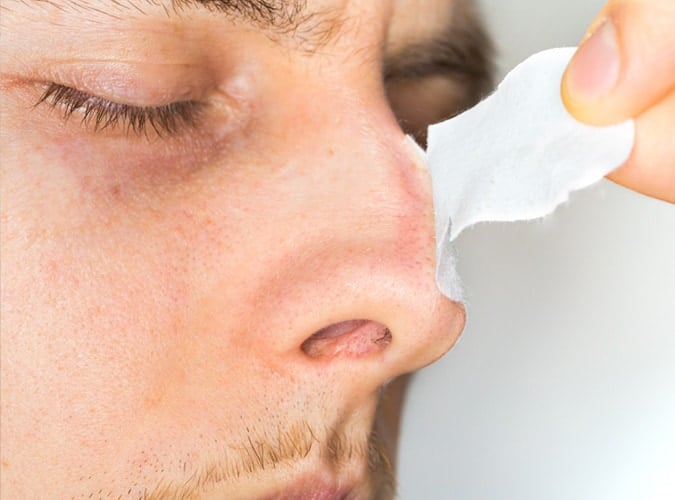 pore strips