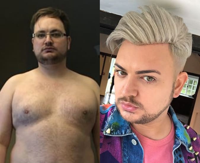 https://www.fashionbeans.com/wp-content/uploads/2019/07/surgery-liam1.jpg