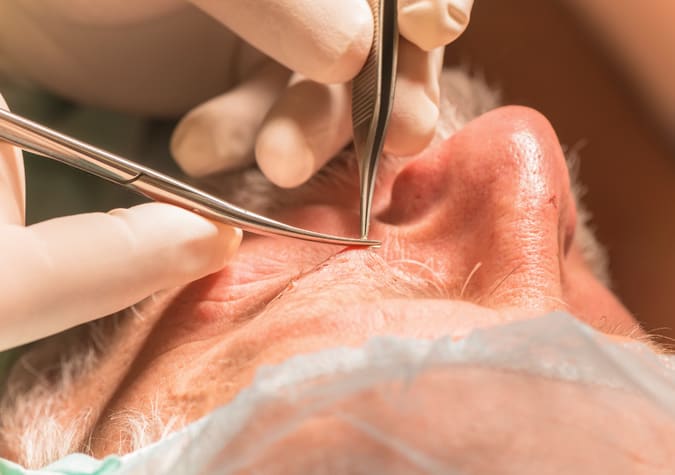 Cosmetic Surgery