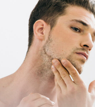 Acne Scars: What They Are And How To Get Rid Of Them